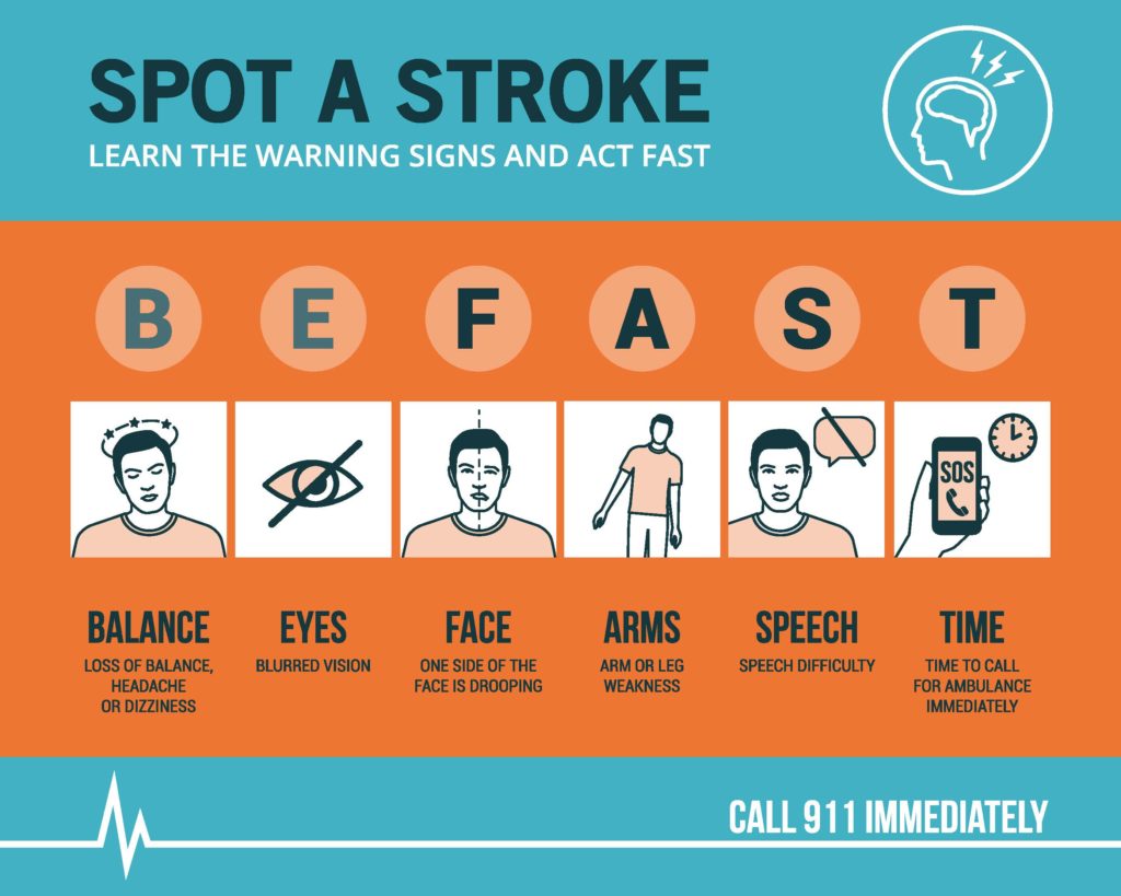 when-it-comes-to-stroke-it-s-important-to-be-fast